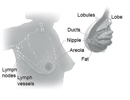 Breast cancer - Breast diagram